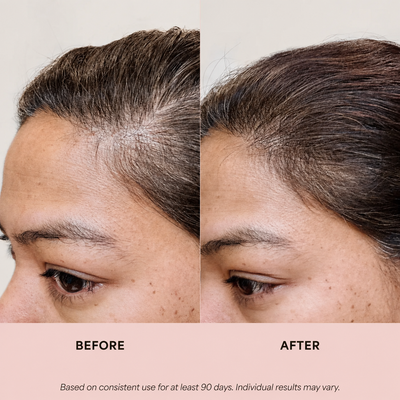 Rosemary & Rice Water Scalp Mist
