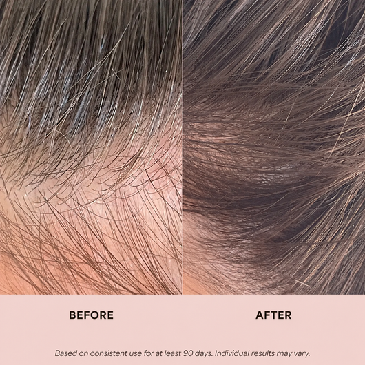 Rosemary & Rice Water Scalp Mist